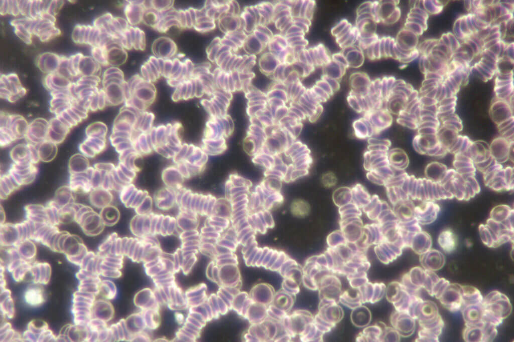 Blutbild vor der Anwendung (ohne CellActivator)